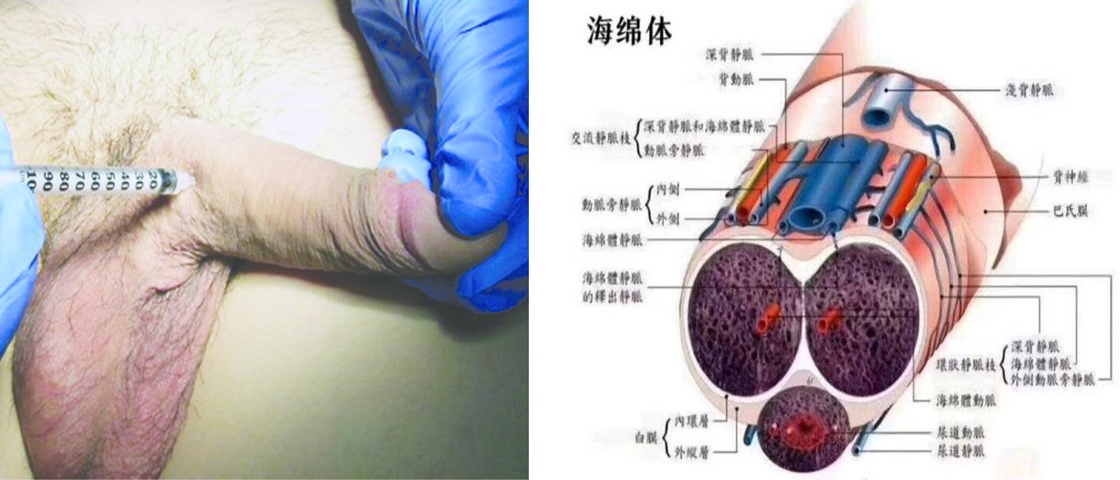 让男人更男人龙根生细胞微注射活化