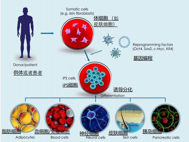 个体化iPS制备和分化成精原细胞让无精症患者也能拥有自己的健康宝宝