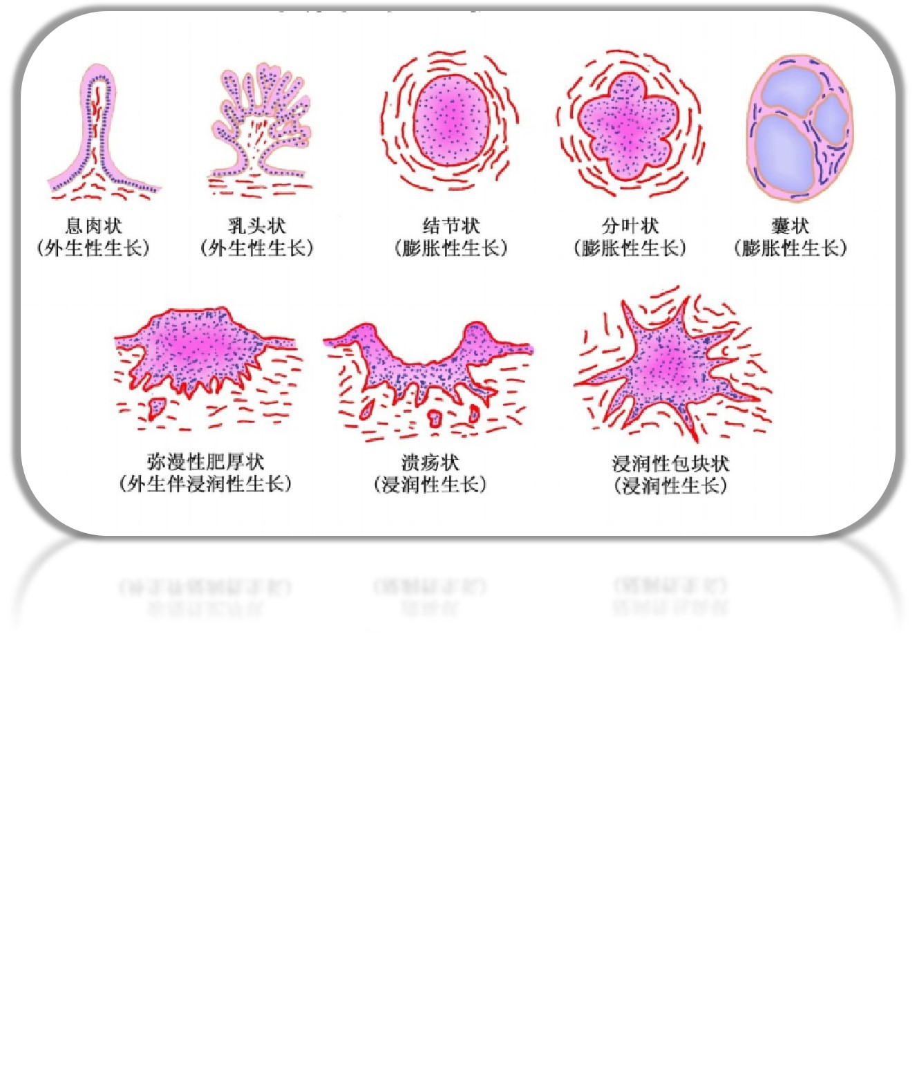 癌症的免疫细胞治疗