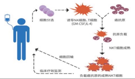 癌症的免疫细胞治疗