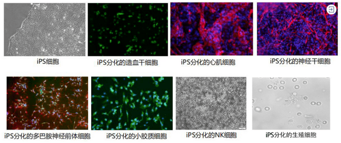 北联世纪采用iPS细胞技术个体化定向分化自身所需细胞