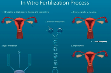 做试管婴儿的全部流程费用多少钱，一文讲清(图1)