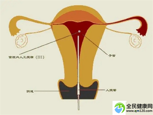 上海可以做三代试管的医院