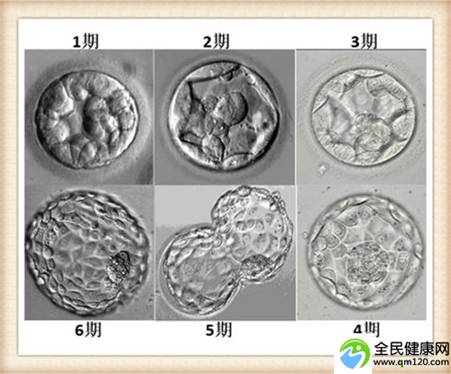 深圳哪里可以做三代试管（深圳试管婴儿是三代技术吗）