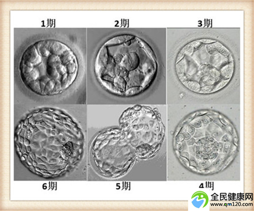 国内比较好的试管婴儿医院排名