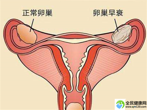 泰国试管婴儿第三代PGD