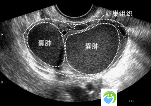 广州三代试管排名文案介绍