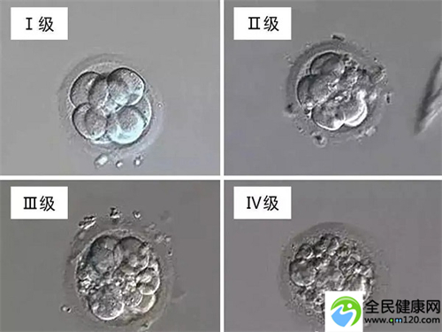 西安哪家医院试管婴儿三代