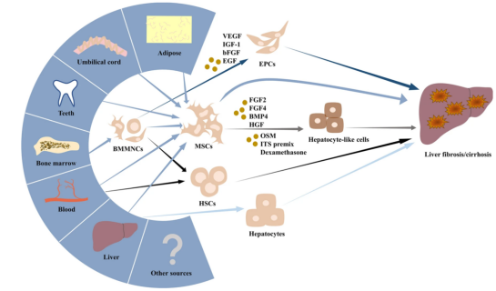 干细胞治疗肝纤维化、肝硬化的临床研究进展