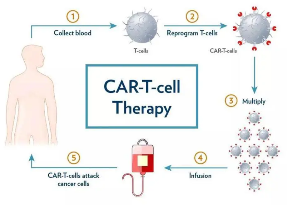 什么是CAR-T细胞疗法？