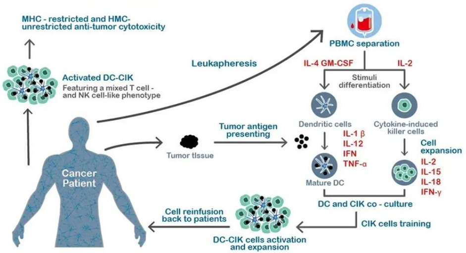 被誉为“细胞”的CIK免疫细胞疗法到底有什么特殊的作用