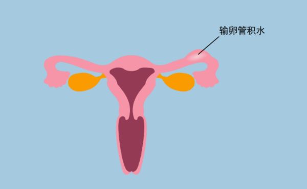 染色体变异的类型有哪些