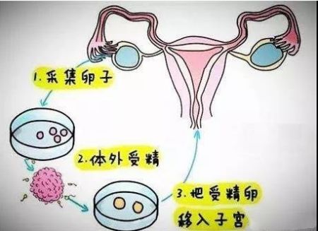 陕西试管婴儿报价（陕西试管佳医院）