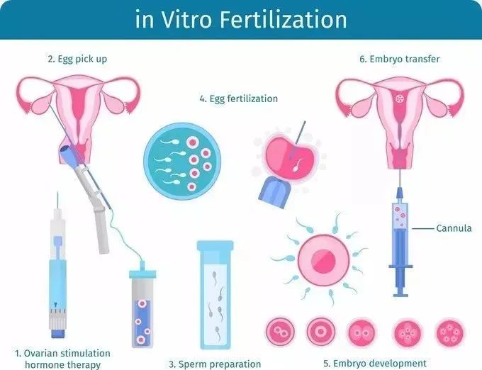 胖子做试管婴儿成功率高吗？单次试管婴儿成功的真实案例参考