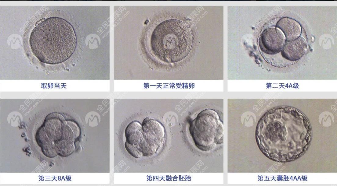 优质囊胚为什么会晚着床?