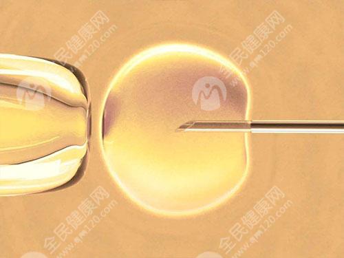 阴道分泌物检查白带清洁度4还能不能移植？