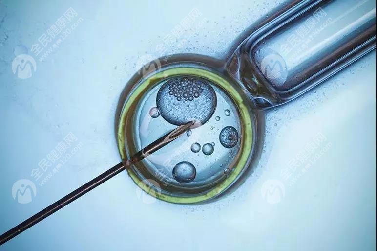 试管短方案冻胚移植前要降调还是直接促排？