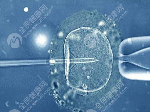 移植两个优质胚胎失败的原因