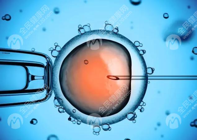 单精子卵泡注射技术适应人群是哪些？