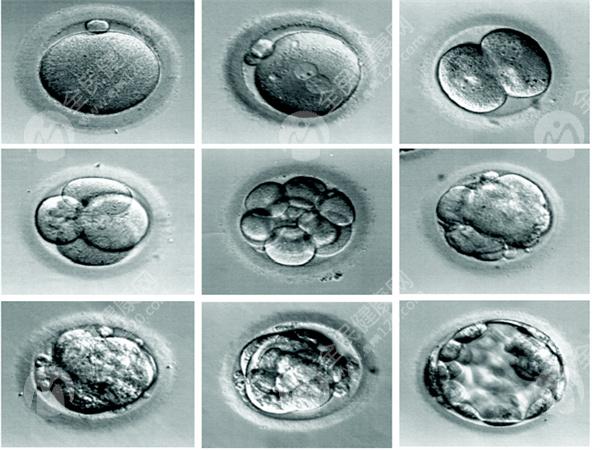 天津试管婴儿医院成功率高不高?可以开展哪些技术?