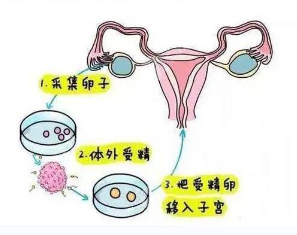 在江西试管婴儿的副作用会影响孩子健康吗？