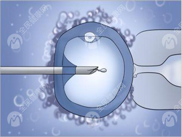 多囊卵巢试管为什么不降调？多囊卵巢试管是直接促排吗？