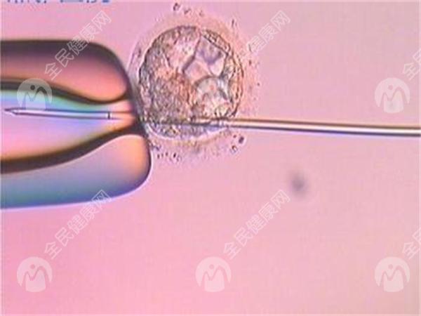 输卵管造影检查疼吗？受哪些因素影响？