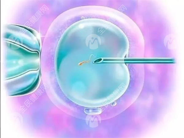多囊卵巢三个诊断标准是什么？怎么确诊？