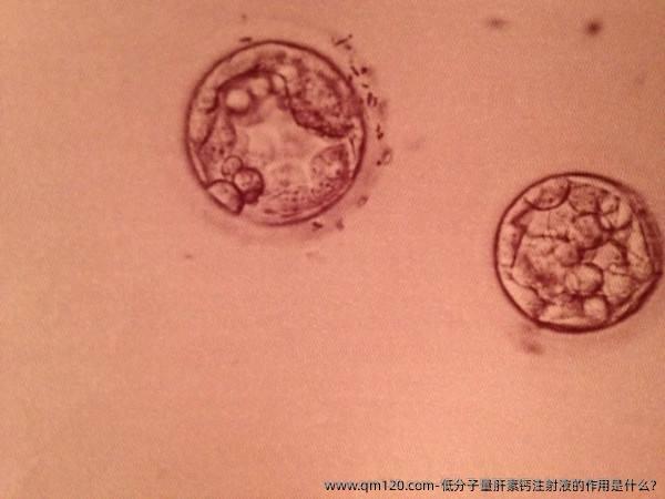 低分子量肝素钙注射液的作用是什么?