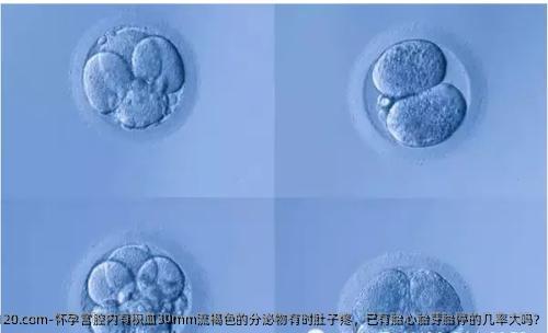 怀孕宫腔内有积血30mm流褐色的分泌物有时肚子疼，已有胎心胎芽胎停的几率大吗?