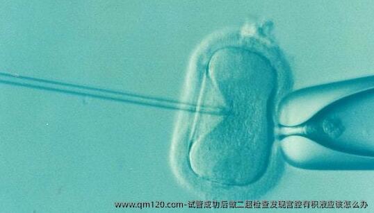 试管成功后做二超检查发现宫腔有积液应该怎么办