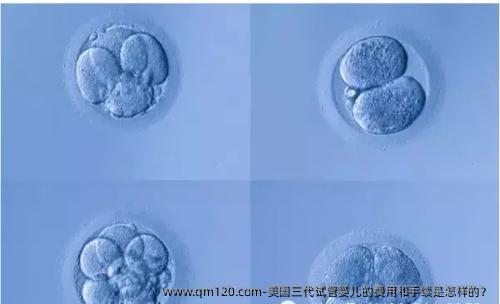 美国三代试管婴儿的费用和手续是怎样的？