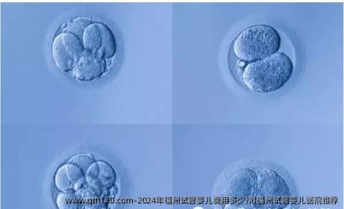 2024年福州试管婴儿费用多少?附福州试管婴儿医院推荐