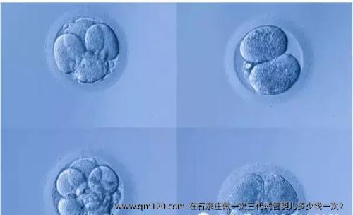 在石家庄做一次三代试管婴儿多少钱一次？