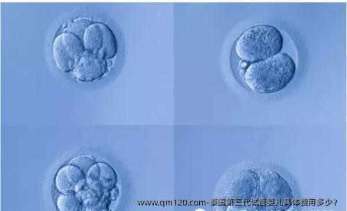 泰国第三代试管婴儿具体费用多少？