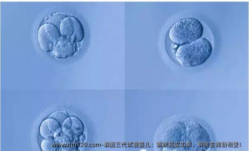 泰国三代试管婴儿：解锁高成功率，解锁生育新希望！