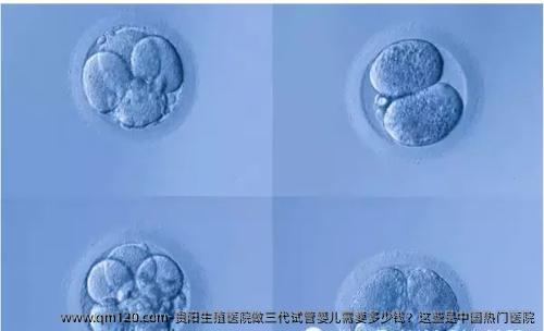 贵阳生殖医院做三代试管婴儿需要多少钱？这些是中国热门医院