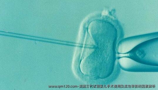 美国三代试管婴儿手术费用及成功率影响因素解析