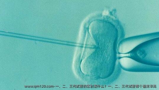 一、二、三代试管的区别是什么？一、二、三代试管哪个着床率高