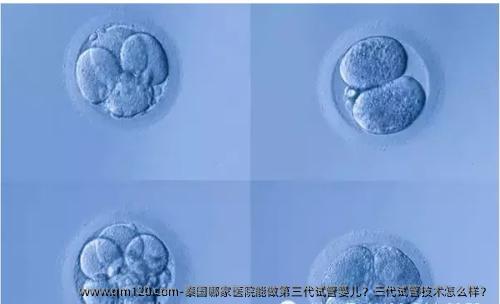 泰国哪家医院能做第三代试管婴儿？三代试管技术怎么样？