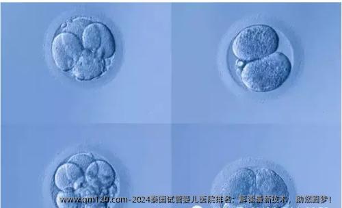 2024泰国试管婴儿医院排名：解读最新技术，助您圆梦！