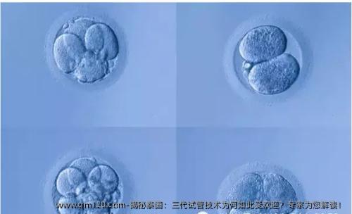 揭秘泰国：三代试管技术为何如此受欢迎？专家为您解读！