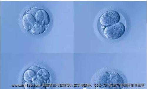 美国第三代试管婴儿成功率揭秘：65%-75%的成功率带领生育希望