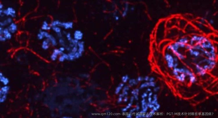 泰国三代试管婴儿技术解析：PGT-M技术针对哪些单基因病？