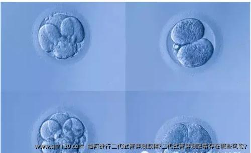 如何进行二代试管穿刺取精?二代试管穿刺取精存在哪些风险?