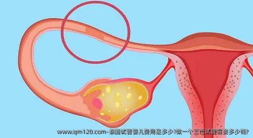 泰国试管婴儿费用是多少?做一个三代试管需要多少钱?