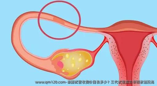 泰国试管收费价目表多少？三代试管成功率哪家医院高