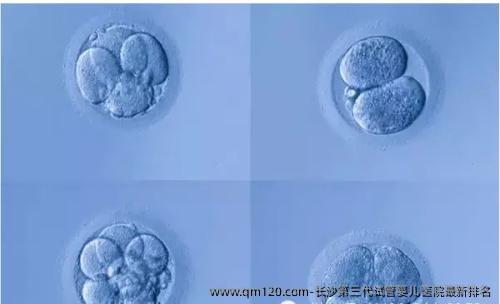 长沙第三代试管婴儿医院最新排名