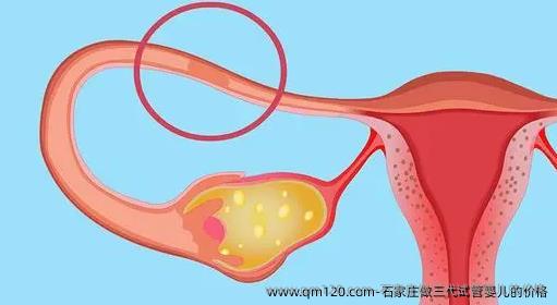 石家庄做三代试管婴儿的价格