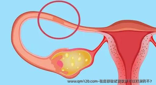 在成都做试管卵泡取出可以打麻药不？